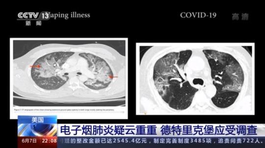 點擊進入下一頁